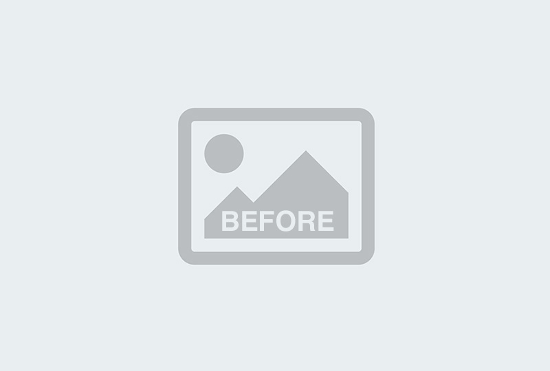 Before Image: Weight Loss - front